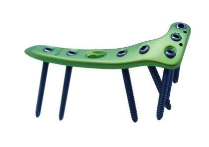 Проксимально-латеральна великогомілкова пластина ІІ, ліва ( Double Medical Technology Inc.)